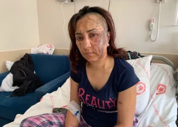 Boşanmak isteyen eşine kezzapla saldırdı