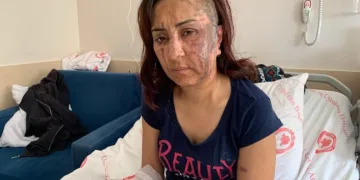 Boşanmak isteyen eşine kezzapla saldırdı