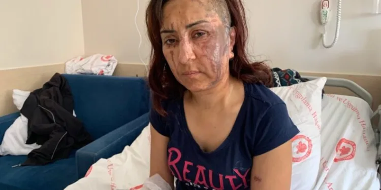 Boşanmak isteyen eşine kezzapla saldırdı