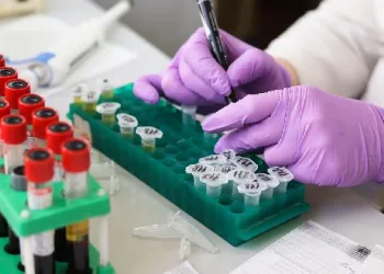 İngiltere’de yüzde 100 doğruluk payı olan virüs testi