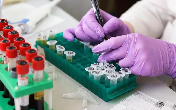 İngiltere’de yüzde 100 doğruluk payı olan virüs testi