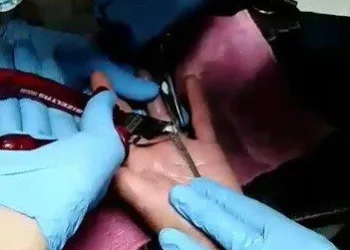 Parmağa Sıkışan Yüzüğü İtfai̇ye Çıkarttı