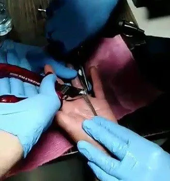 Parmağa Sıkışan Yüzüğü İtfai̇ye Çıkarttı