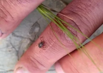 Kene ısırığı can aldı!