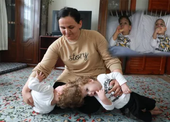 Başlarından yapışık siyam ikizleri şehir hastanesine yerleştirildi