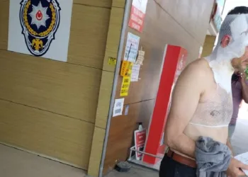 Bursa’da fabrikada kaza! Yüzü ve vücudu yandı…