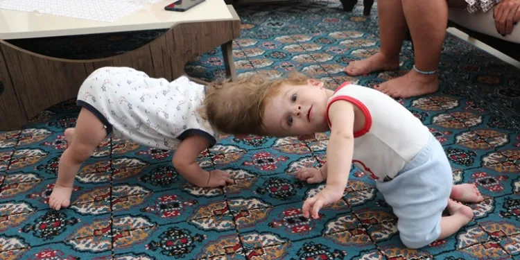 Ameliyatla ayrılan siyam ikizlerinin ilk fotoğrafları…