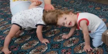 42 kişilik ekip ameliyat etti. Çarşamba geliyorlar!