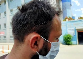 Bursa’da minibüsün çarptığı antrenör kafa travması geçirdi