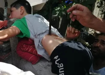 Ağaçtan düşen çocuğa inşaat demiri saplandı