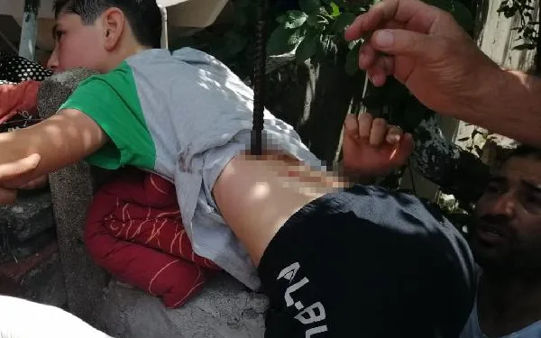 Ağaçtan düşen çocuğa inşaat demiri saplandı