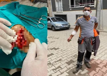 Temizlik işçisi yaralandı, Başkan Taban tepki gösterdi