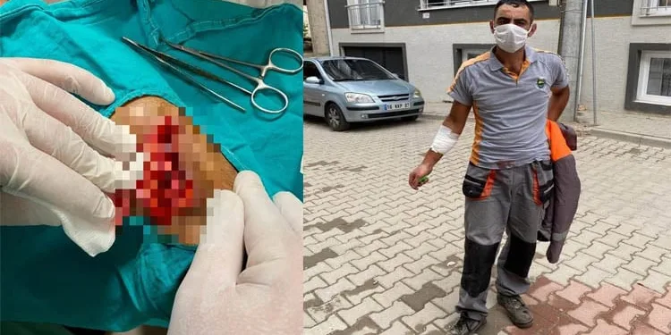 Temizlik işçisi yaralandı, Başkan Taban tepki gösterdi