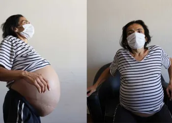 Karnındaki 15 kiloluk tümörle yardım bekliyor