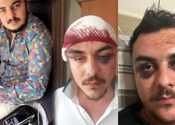 4 kişi tarafından feci şekilde dövüldü, 4 gün komada kaldı
