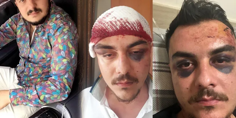4 kişi tarafından feci şekilde dövüldü, 4 gün komada kaldı