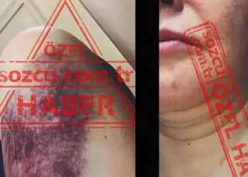 Eski başbakanın oğlundan eşine darp iddiası