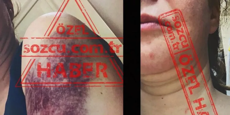 Eski başbakanın oğlundan eşine darp iddiası