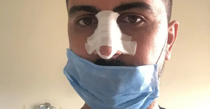 Saldırıya uğrayan hemşirenin isyanı: Şiddet Covid dinlemiyor