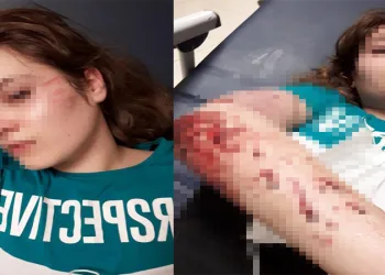 Kendisini döven ağabeyinden kaçmak için 2’nci kattan atladı