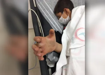 Zehirli yılanın ısırdığı Civan’ın sağlık durumu ciddiyetini koruyor