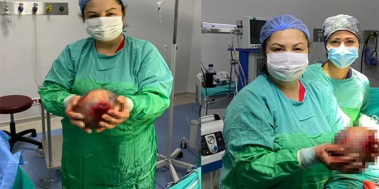 Rahminden 1,5 kiloluk kist çıktı