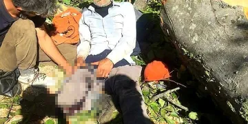 Tomruğun altında kaldı bacağı kesildi