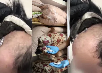 Peruğunun altından uyuşturucu çıktı