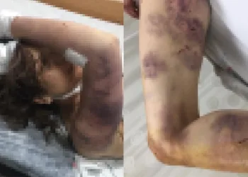 Kan donduran olay! Zincirle dövüp, tırnaklarını çekti