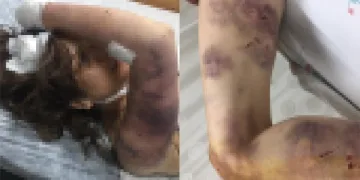 Kan donduran olay! Zincirle dövüp, tırnaklarını çekti