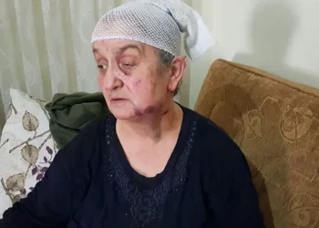 Ölü taklidi yaparak kurtuldu