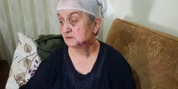 Ölü taklidi yaparak kurtuldu