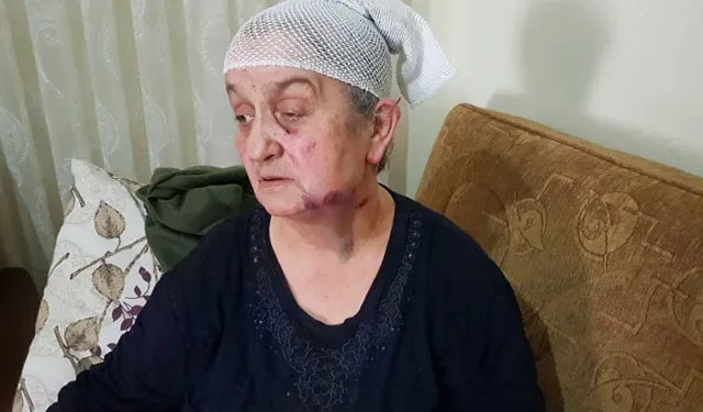 Ölü taklidi yaparak kurtuldu