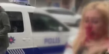 İş yerine gelen kadını darbetti