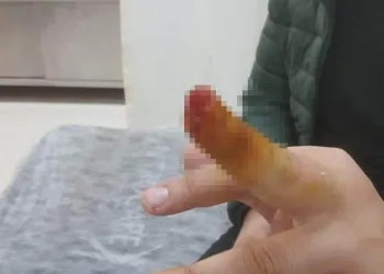 Tartıştığı güvenlik görevlisinin parmağını ısırıp, kopardı