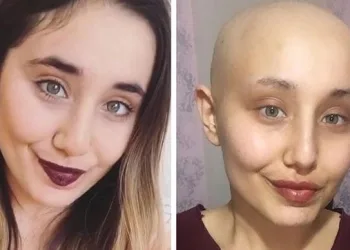 Kanser tedavisi gören Ayyüce ‘melek’ oldu