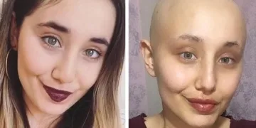 Kanser tedavisi gören Ayyüce ‘melek’ oldu