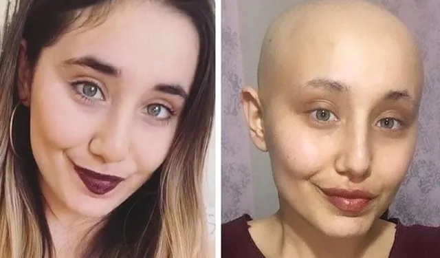 Kanser tedavisi gören Ayyüce ‘melek’ oldu