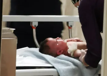 Bursa’da üzerine kaynar su dökülen bebek, ağır yaralandı