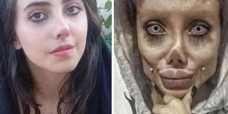 İranlı ‘Zombi Gelin’e hapis şoku