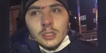 Buzda kayarken düştü, hafıza kaybı yaşadı