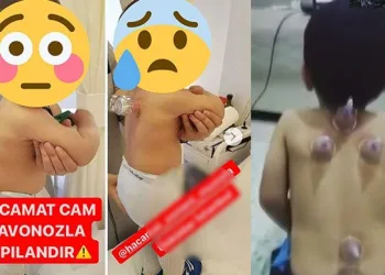 Sosyal medyadaki görüntülere uzmanlardan uyarı