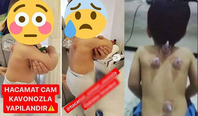 Sosyal medyadaki görüntülere uzmanlardan uyarı