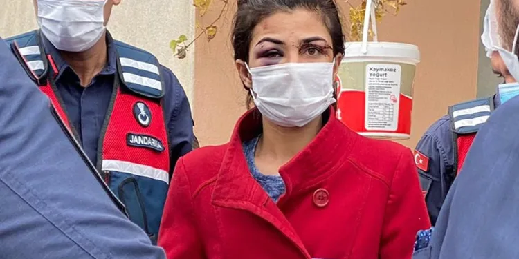 İşkenceci kocasını öldürmüştü! İfadesi kan dondurdu