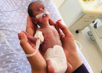 520 gram doğan Nisa bebek yaşama tutundu
