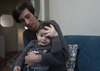Bir eli ve ayağı anormal şekilde hızla büyüyor