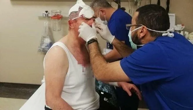 Özdağ’a saldırıda 4 gözaltı daha