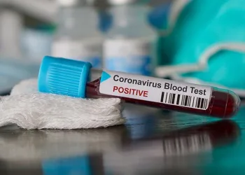 Türkiye’de Covid-19’dan son 24 saatte 137 can kaybı