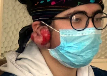 Taktığı küpeler kabusu oldu! Tedavi olmazsa duyamayacak
