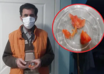 Kestiği domates eline battı! Gördüklerine anlam veremedi